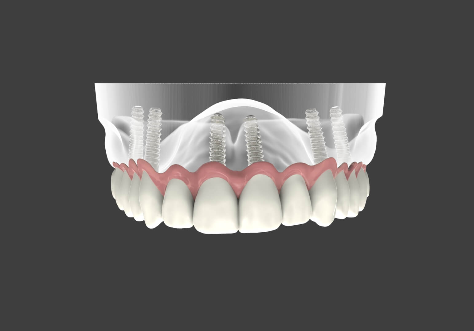 Featured image for “Dental Implants and Oral Surgery”
