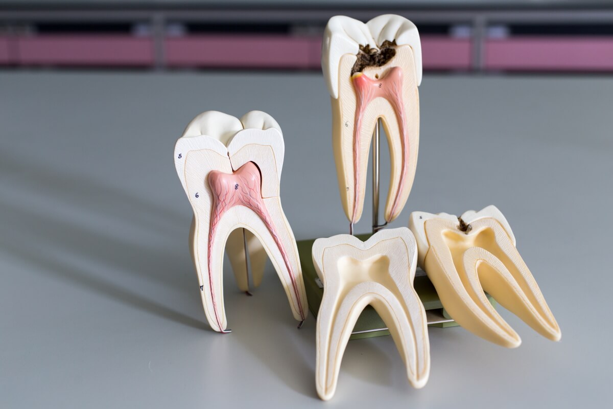 Featured image for “Root Canal Therapy”